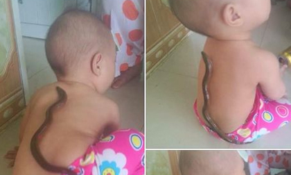 Thực hư hiệu quả việc hạ sốt nhanh cho trẻ bằng... lươn sống