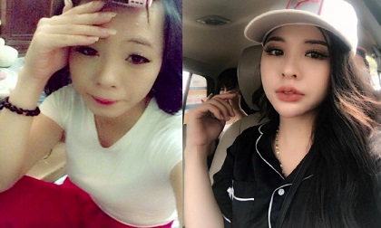 9X 'vịt hóa thiên nga' sau khi chi gần 300 triệu phẫu thuật thẩm mỹ