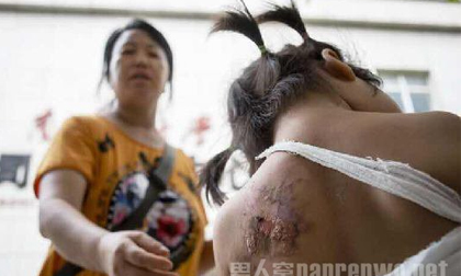 Bé gái 2 tuổi tử vong vì bị mợ phun nước nóng vào người sau khi tè dầm