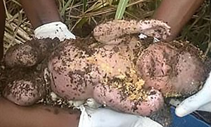 Bé sơ sinh sống sót kỳ diệu sau 3 ngày bị chôn sống