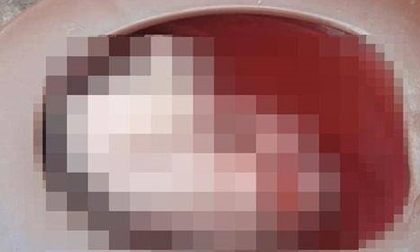 SỐC: Sản phụ đẻ rơi con xuống bồn cầu mới hoảng loạn khi biết mình mang thai