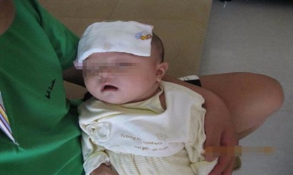 Cháu há miệng nên bà cho ăn vài thìa trứng, ít phút sau phải nhập viện khẩn cấp