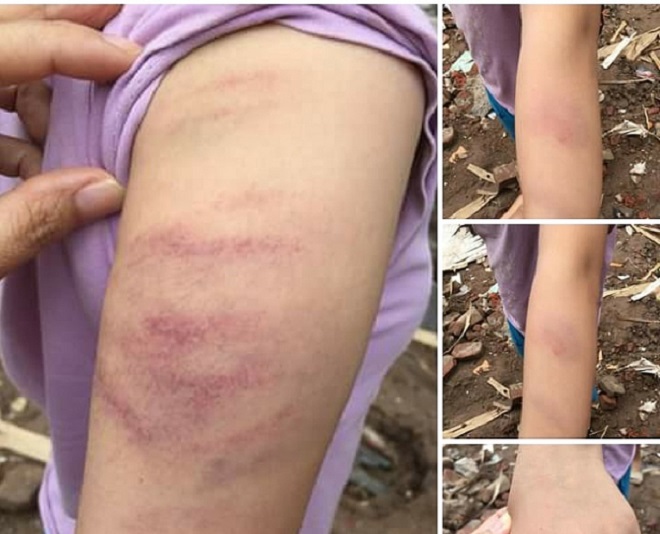 Tạm đình chỉ cô giáo đánh học sinh vì làm thiếu bài tập