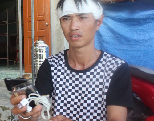 be 8 tuoi dau don cat bo ban tay, da den luc cha me dung ngay viec choi dien thoai khi sac - 4
