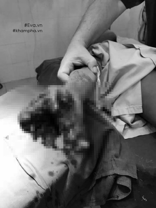 be 8 tuoi dau don cat bo ban tay, da den luc cha me dung ngay viec choi dien thoai khi sac - 2