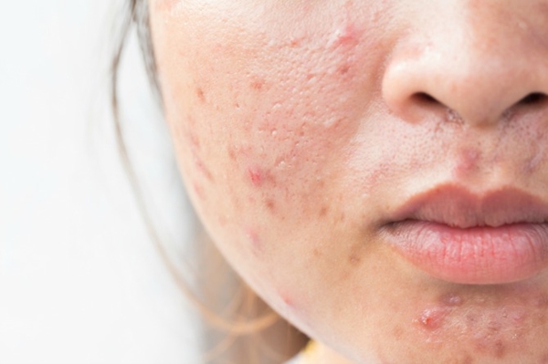7 lợi ích khổng lồ của sữa mẹ có thể bạn chưa biết - Ảnh 4.