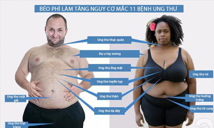 Béo phì làm tăng cao nguy cơ mắc 11 bệnh ung thư