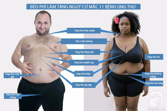 Béo phì làm tăng cao nguy cơ mắc 11 bệnh ung thư - Ảnh 1.