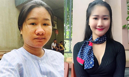 Bà bầu xấu 'hiếm có khó tìm' đẹp mơn mởn khi giảm 32kg