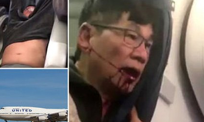 United Airlines phải trả bao nhiêu cho sự im lặng từ bác sĩ Dao?