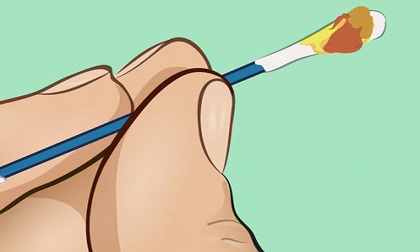 Màu sắc ráy tai tố cáo gì về sức khỏe của bạn?