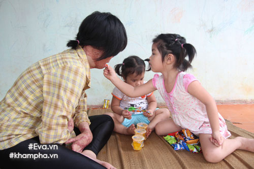 nghi luc phi thuong cua co gai 9x chi con 1% co hoi song do bi chong thieu xang - 1