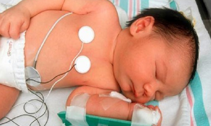 Bé 7 tháng nhiễm trùng phổi nghiêm trọng vì mẹ ham làm đẹp... ngực