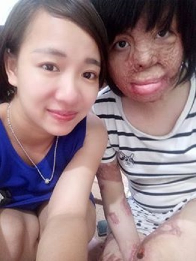 
Thùy Dung có thêm những người bạn khi cộng đồng biết hoàn cảnh (ảnh nhân vật cung cấp)
