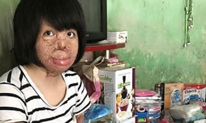 Cô gái 9x bị chồng thiêu xăng: “Chồng bảo ra tù sẽ kiếm tiền nuôi em”