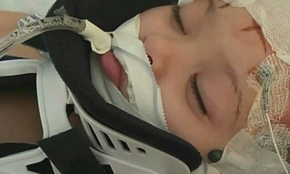 Bé gái 2 tuổi tổn thương não vì bị bảo mẫu là một cậu thiếu niên 16 tuổi trừng phạt