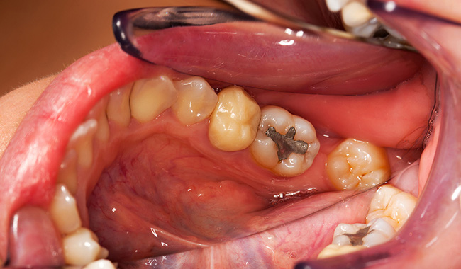 Thói quen ngủ há miệng và những tác hại đến không ngờ - Ảnh 2.
