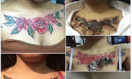 Thực hư cô gái xóa xăm vì sợ người yêu bỏ và hậu quả đáng tiếc gây sốc mạng xã hội