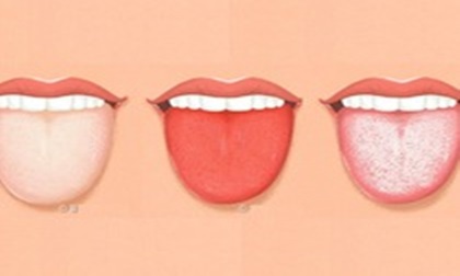 Lưỡi có 4 biểu hiện này, hãy đi kiểm tra sức khoẻ cấp tốc