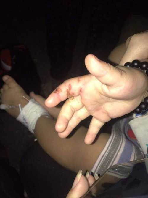 Bình Dương: Nghi án bé trai 2 tuổi bị bạn trai của mẹ bạo hành - 2