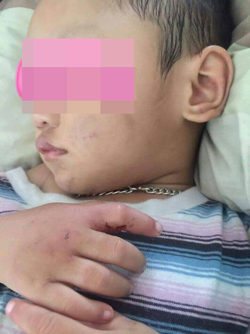 Bình Dương: Nghi án bé trai 2 tuổi bị bạn trai của mẹ bạo hành - 3