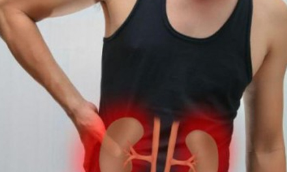 Nếu không muốn bị sỏi thận, hãy cẩn trọng khi ăn những thực phẩm này