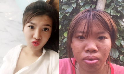 Sau khi 'đập mặt xây lại', Phượng 'Thị Nở' muốn có thân hình chữ S