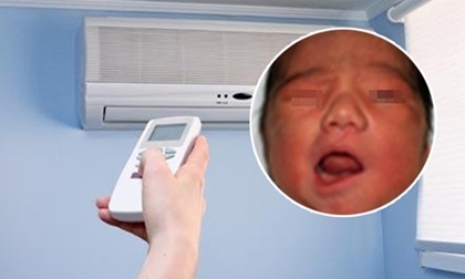 Bố mẹ sử dụng điều hòa không đúng cách, con nhỏ bị liệt mặt, méo miệng