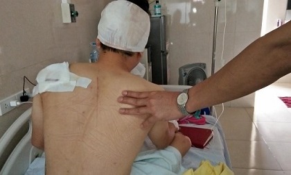 Hà Nội: Côn đồ chém người tại chung cư Mandarin Garden