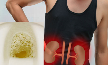 Nước tiểu có bọt, cảnh báo những bệnh nguy hiểm bạn phải biết
