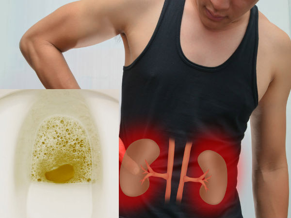 nuoc tieu co bot, canh bao nhung benh nguy hiem ban phai biet - 1