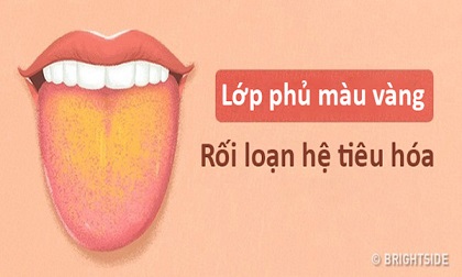 Màu lưỡi nói lên tình trạng sức khỏe của bạn thế nào?