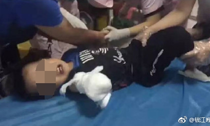 Vấp ngã khi đi ngược chiều, bé trai 4 tuổi bị thang cuốn nghiến đứt lìa cánh tay