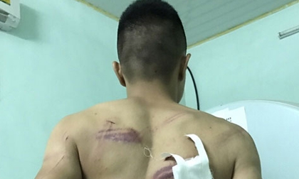 Bắt 7 nghi phạm truy sát ba người đàn ông giữa ban ngày