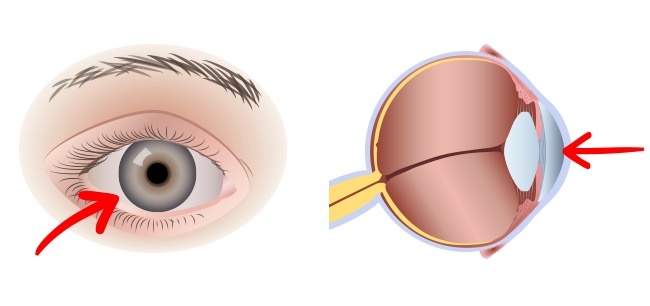 Quan niệm ăn trứng nhiều có hại xưa rồi, 2 quả mỗi ngày cho lợi ích thần kỳ - 2