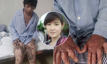 Ký ức đau thương của người vợ sống sót sau khi bị chồng nhốt rồi tưới xăng đốt cả hai