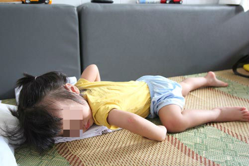be gai 4 tuoi dot ngot bi meo mom, liet mat sau giac ngu trua trong dieu hoa - 3