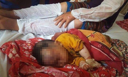 Lào Cai: Nổ khí gas, 10 người trong gia đình bị bỏng nặng