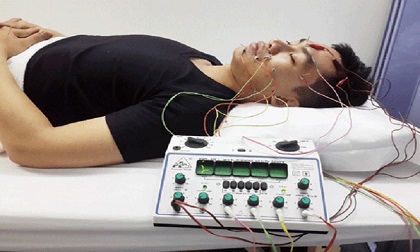 Méo miệng, liệt mặt vì điều hòa