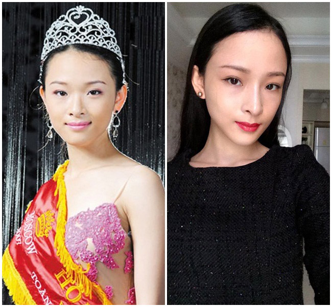 nhan sac that cua truong ho phuong nga truoc khi phau thuat tham my - 3