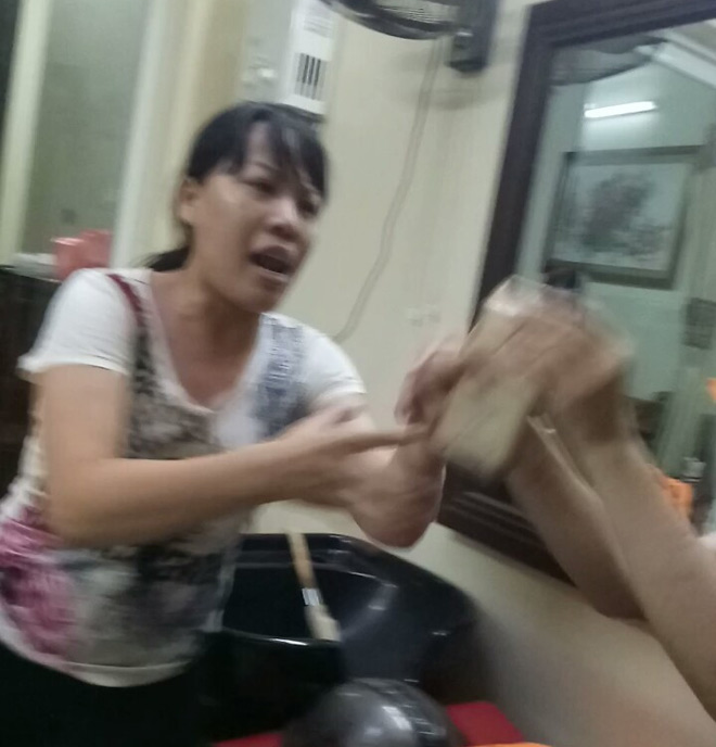 Được chủ quán gội đầu “chăm sóc”, khách chấn thương sọ não - 3