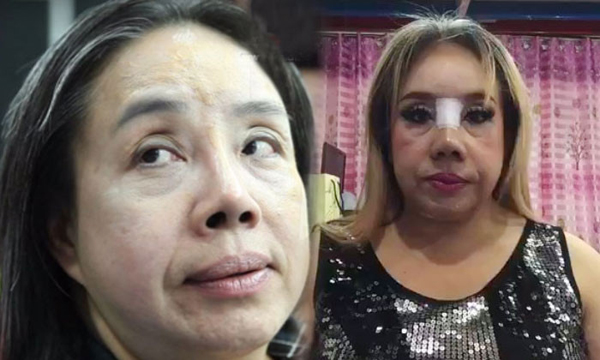 nu dai gia thai lan 'yeu' 28 lan/ngay xuat hien tro lai voi chiec mui