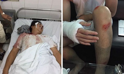 Truy bắt nhóm côn đồ hành hung dã man khiến 4 người nhập viện