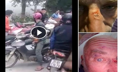 Bất ngờ với tâm thư của người bạn ông Tây bị 5 người Việt đánh ở Sa Pa