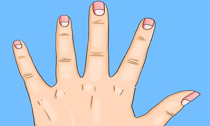 Bắt bệnh chuẩn xác thông qua móng tay có hình bán nguyệt