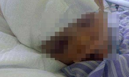 Bé gái 5 tuổi bị người lạ đánh đến hôn mê khi nhận hàng chuyển phát nhanh