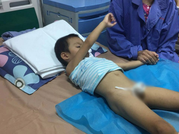 Hàng loạt trẻ bị sùi mào gà sau cắt bao quy đầu: Sở Y tế Hưng Yên nói gì? - 1