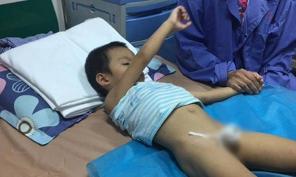 Hàng loạt trẻ bị sùi mào gà sau cắt bao quy đầu: Sở Y tế Hưng Yên nói gì?