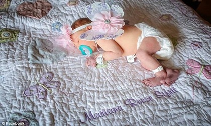 Khách lạ đến thăm và hôn khiến bé sơ sinh 18 ngày tuổi tử vong