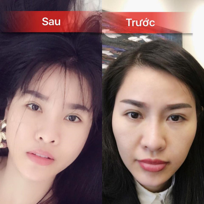 Nghi vấn qua cầu rút ván của nữ hoàng thị phi Quế Vân: thẩm mỹ xinh đẹp xong trở mặt với người giúp đỡ? - Ảnh 1.